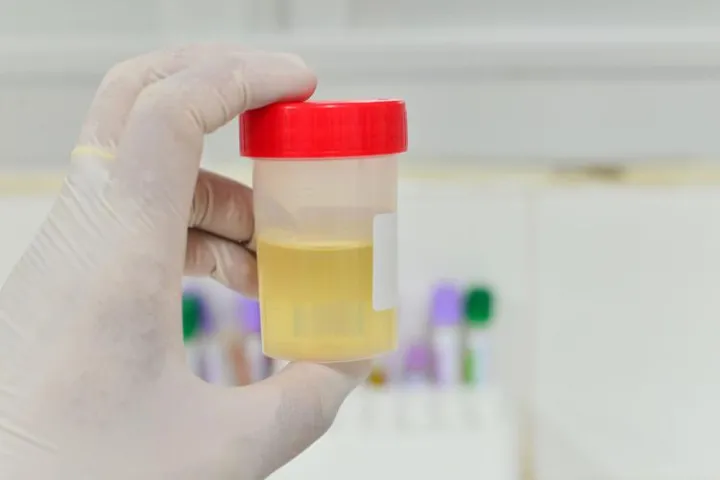 Dai segnali del colore alla postura, sui social è 'urina mania' tra scienza e falsi miti