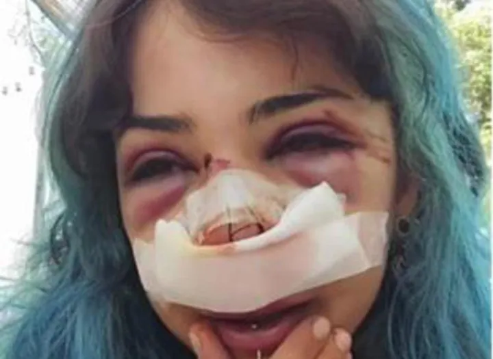 Bari, studentessa picchiata nei bagni denuncia nuovo episodio: 