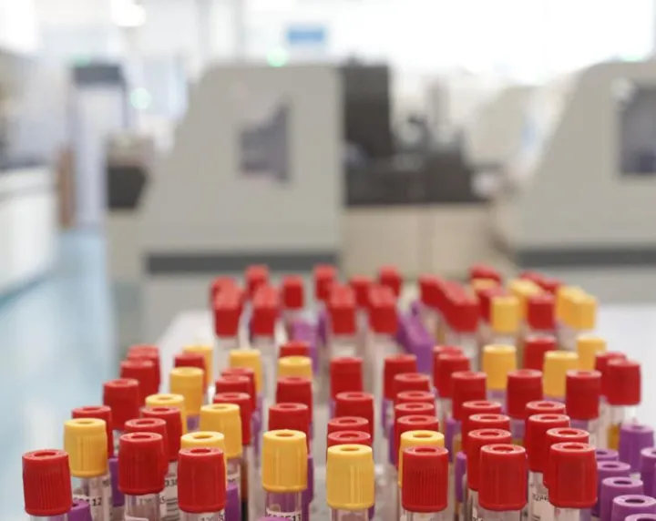 Malaria in aeroporto in Germania, gli esperti: 